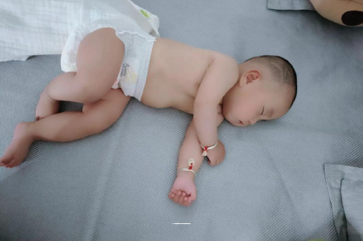 赵县六个月宝宝眼睛散光